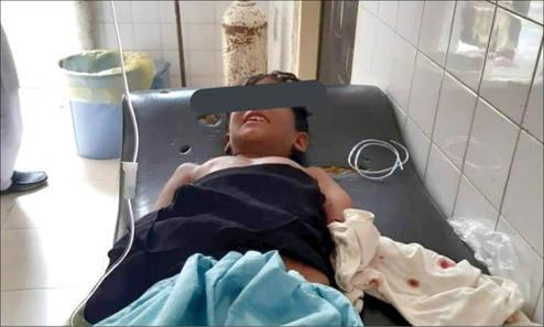 «گاندو»‌ دست‌ پسر‌ بچه‌ چابهاری‌ را‌ خورد +عکس