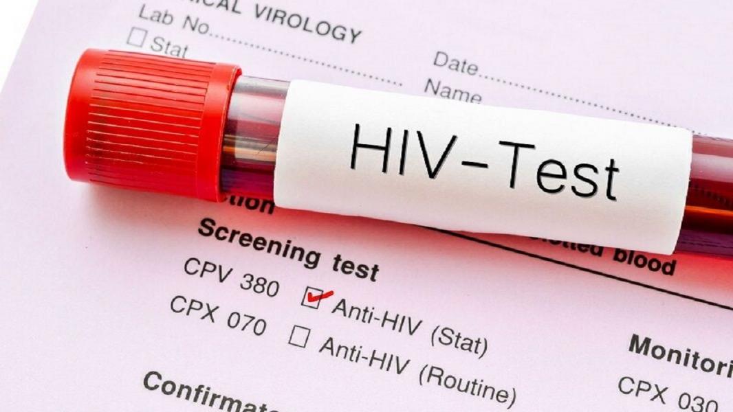 شناسایی ۱۰۸ بیمار مبتلا به ایدز در قزوین