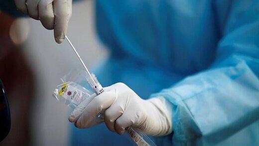 تعرفه تست PCR و قیمت کیت تشخیصی اعلام شد