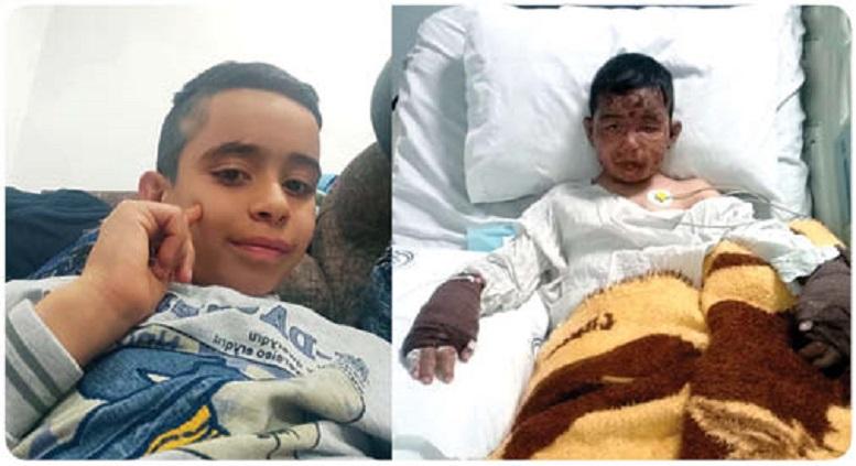 پسر ۸ ساله شیرازی، ۴ کودک را ازمیان آتش نجات داد