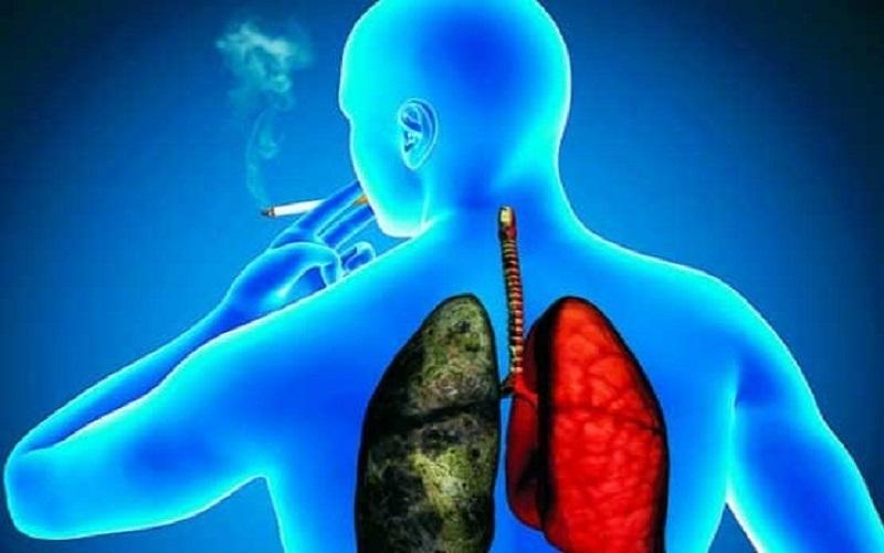 ترک دخانیات؛ بهترین راه برای رهایی از (COPD)