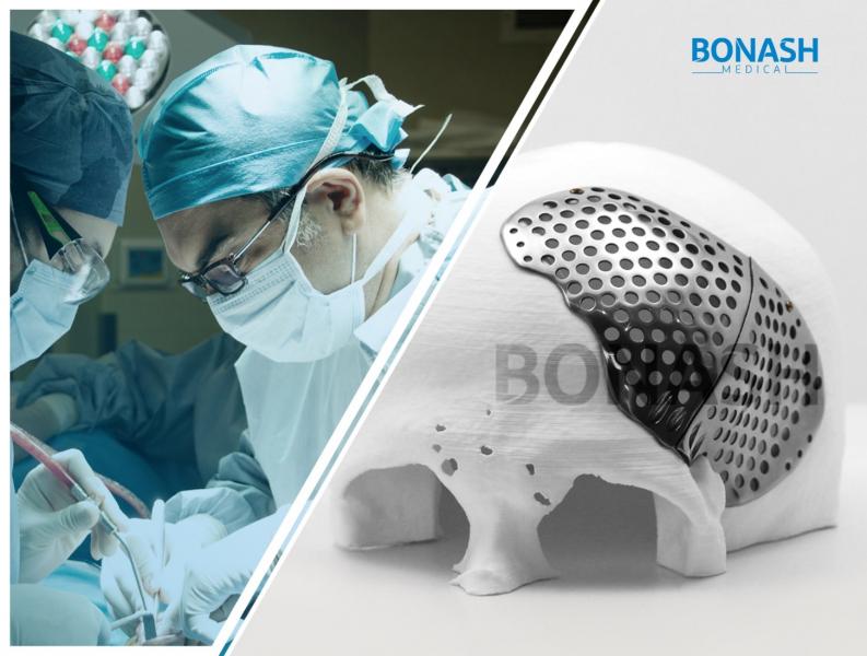 بازسازی صدمات صورت با تکنولوژی پرینت‌سه‌بعدی