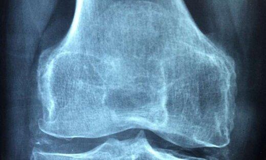 پیشگیری از رماتیسم با واکسن