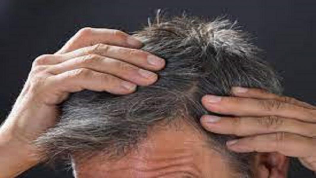 از راهکارهایی برای کاهش سفیدی زودرس موی سر تا رونمایی از تست خانگی تشخیص کرونا