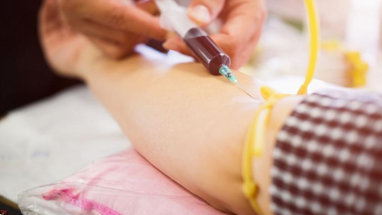  برای نخستین بار در دنیا یک زن مبتلا به اچ آی وی با پیوند سلول های خون بند ناف درمان شد 