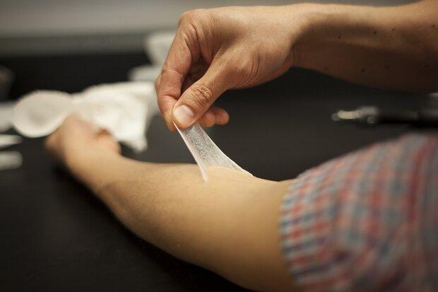 جایگزین پوست بدن به روش چاپ زیستی تولید شد