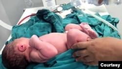آمار رسمی روزانه بیش از «هزار مورد» سقط جنین در ایران به رغم محدودیت‌های قانونی