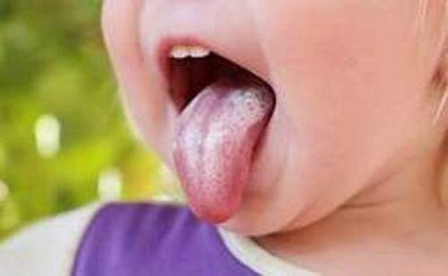 زبان باید چه رنگی باشد و رنگ‌های مختلف زبان انسان چه چیزی را نشان می‌دهند؟