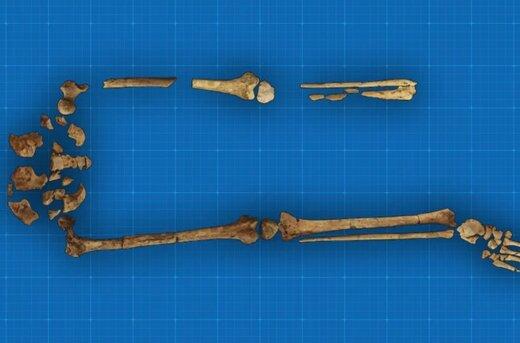 ۳۱ هزار سال عمر اولین قطع عضو پزشکی تاریخ!