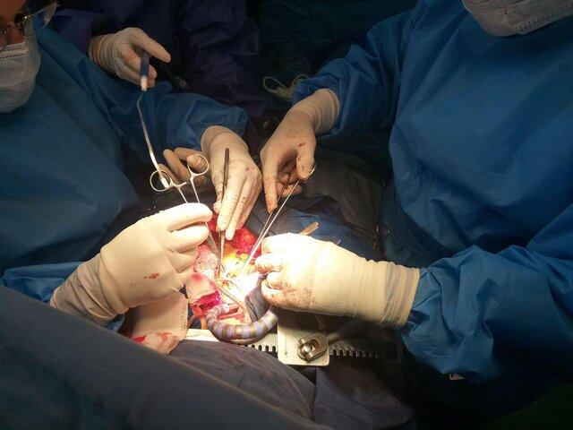 برای نخستین بار در جهان روش جدید جراحی قلب در شیراز اجرا شد