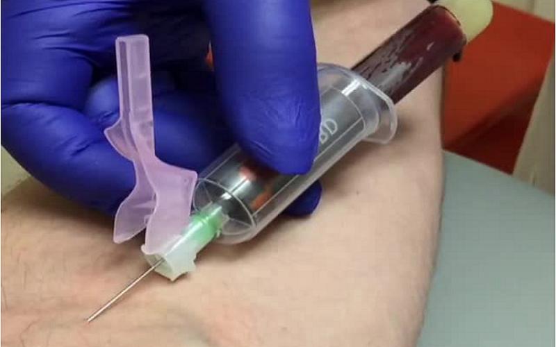 فصد خون چیست و چه کاربردهایی دارد؟