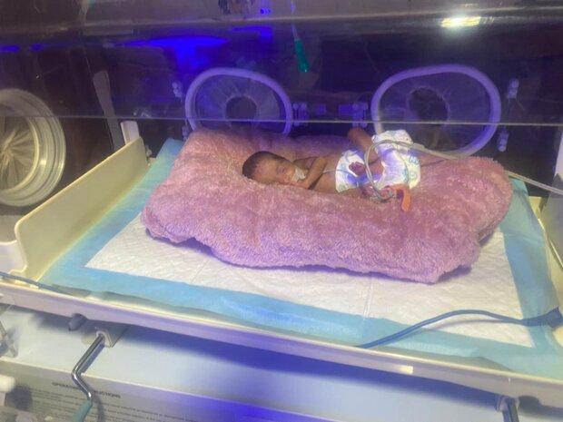 بارداری برای زنان مبتلا به لوپوس پرریسک است