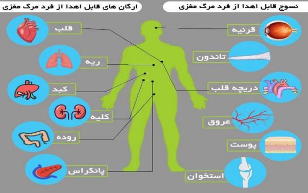 اهدای عضو در ایران، کُند و دیر