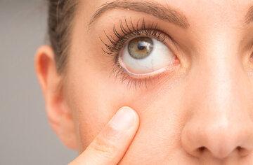 علائم بیماری خشکی چشم را بشناسید/ بهترین راه برای درمان