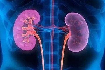 مصرف این ماده خوراکی باعث سنگ کلیه می‌شود