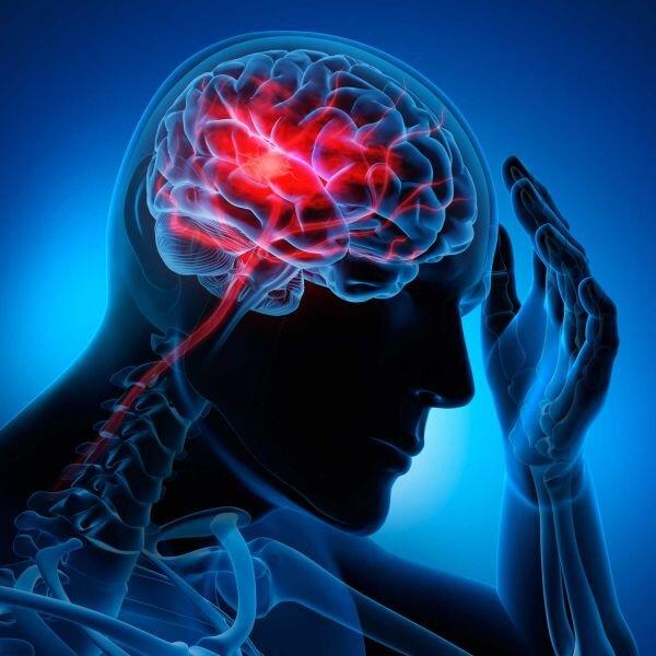 علایم و نشانه‌های سکته مغزی