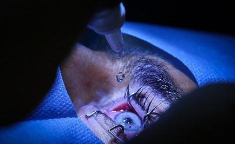 آگهی‌های فروش "قرنیه" کلاهبرداری است