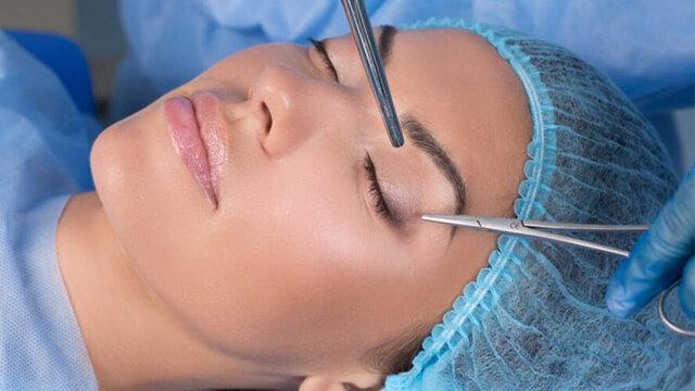 نکاتی درباره عمل جراحی پلک