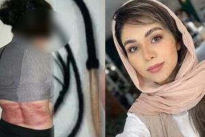 روایتی هولناک از شلاق‌خوردن به خاطر حجاب - Gooya News