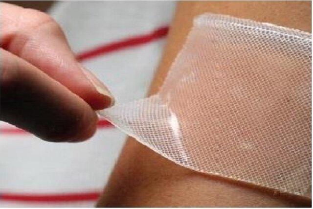 کاهش ۹۱ درصدی خونریزی جراحات با پانسمان‌های نانو ساختار