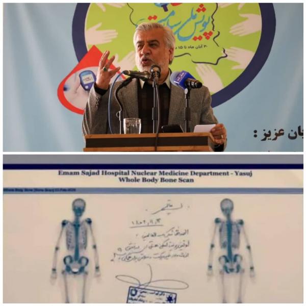 انجام اسکن تمام بدن استخوان با تزریق داروی پرتوزا برای اولین بار در مرکز پزشکی هسته‌ای یاسوج