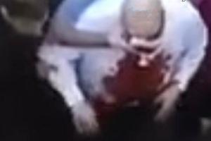 آسیب جدی چشم به و دست جمهوری اسلامیدر بیروت + فیلم لحظه انتقال او به بیمارستان - Gooya News